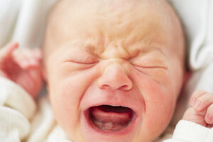 birth injury